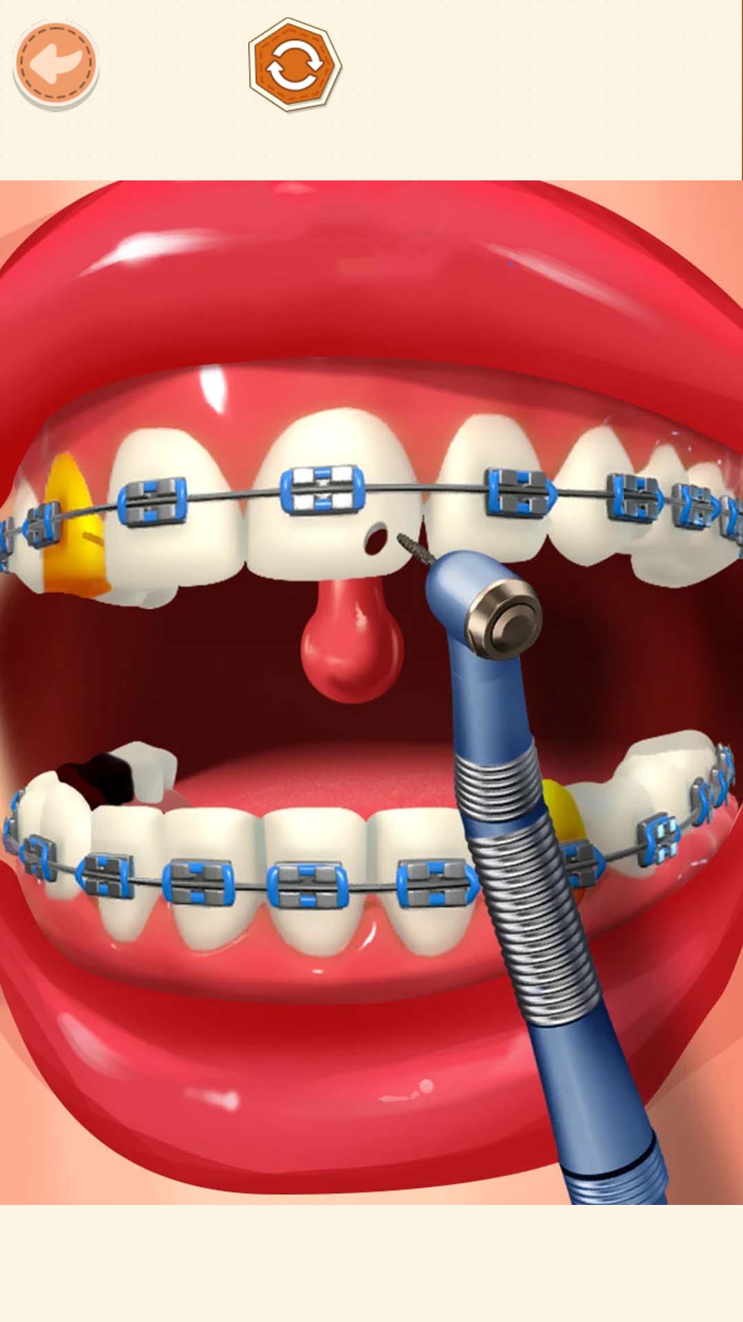 高级医生模拟截图2