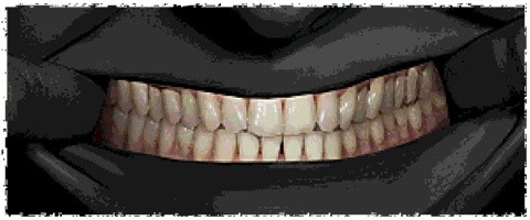 寻找伪人移植版玩法介绍2